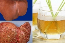 Thảo dược vườn nhà giúp thải độc gan hiệu quả